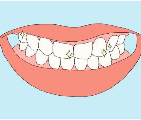超薄牙贴面，分享超薄牙贴面的优势是什么？