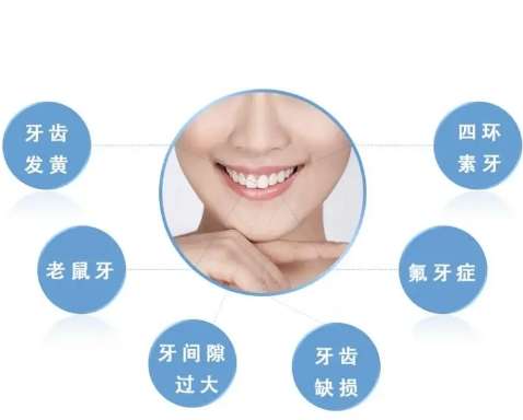复合树脂贴面.jpg